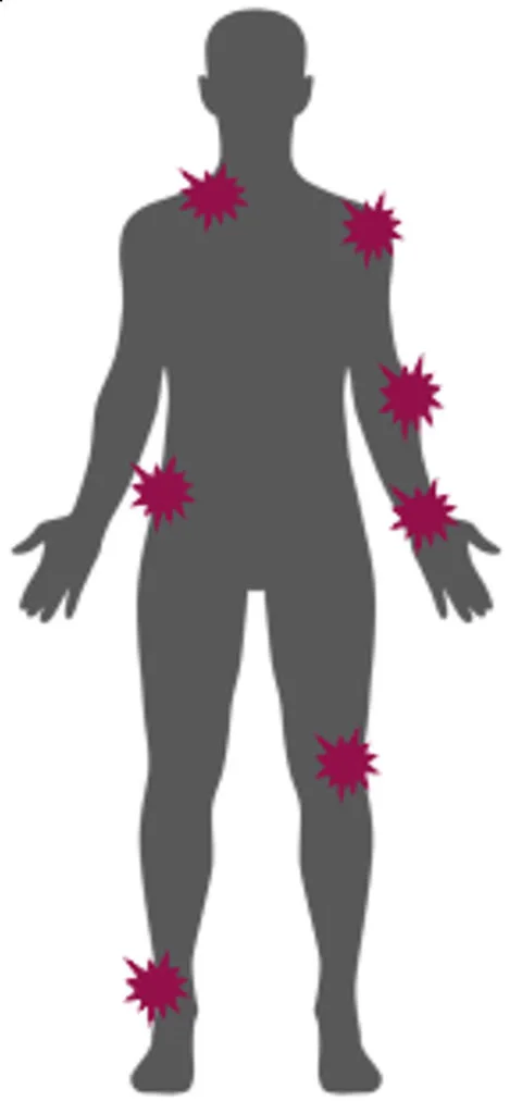 L'échauffement au travail